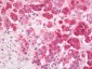 Anti-HLA-DQA1 Antibody 